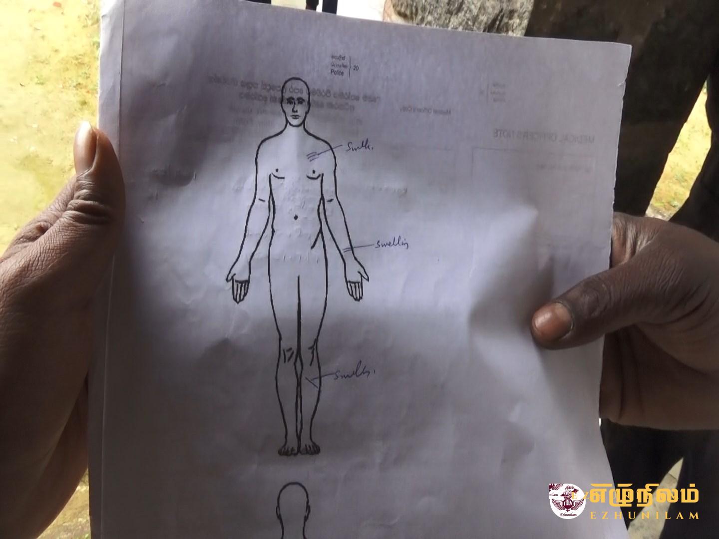 மாணவியை விரட்டி விரட்டித் தும்புத்தடியால் தாக்கிய அதிபர்; வைத்தியசாலையில் மாணவி அனுமதி மாணவியை விரட்டி விரட்டித் தும்புத்தடியால் தாக்கிய அதிபர்; வைத்தியசாலையில் மாணவி அனுமதி