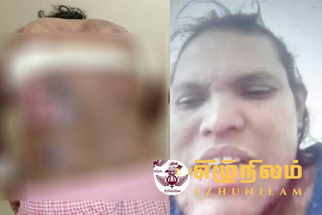 சவுதியில் வீட்டுப் பணிப்பெண் ஒருவருக்கு தீ வைப்பு