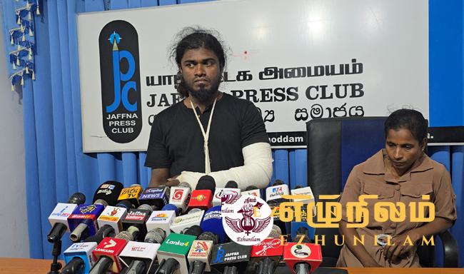 சித்திரவதை செய்த பொலிஸார் எனது கையை முறித்துள்ளனர் சித்திரவதை செய்த பொலிஸார் எனது கையை முறித்துள்ளனர்